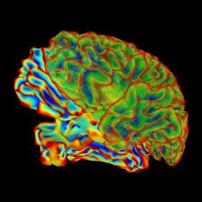 Seizures During Menstrual Cycle Lined to Drug-Resistant Epilepsy